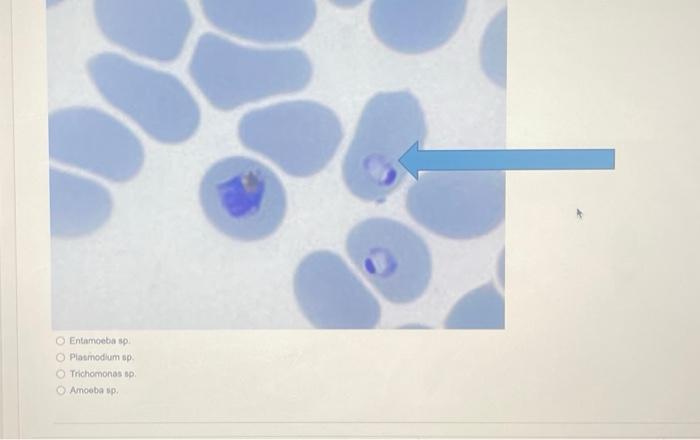 Solved Trichomonas sp: | Chegg.com