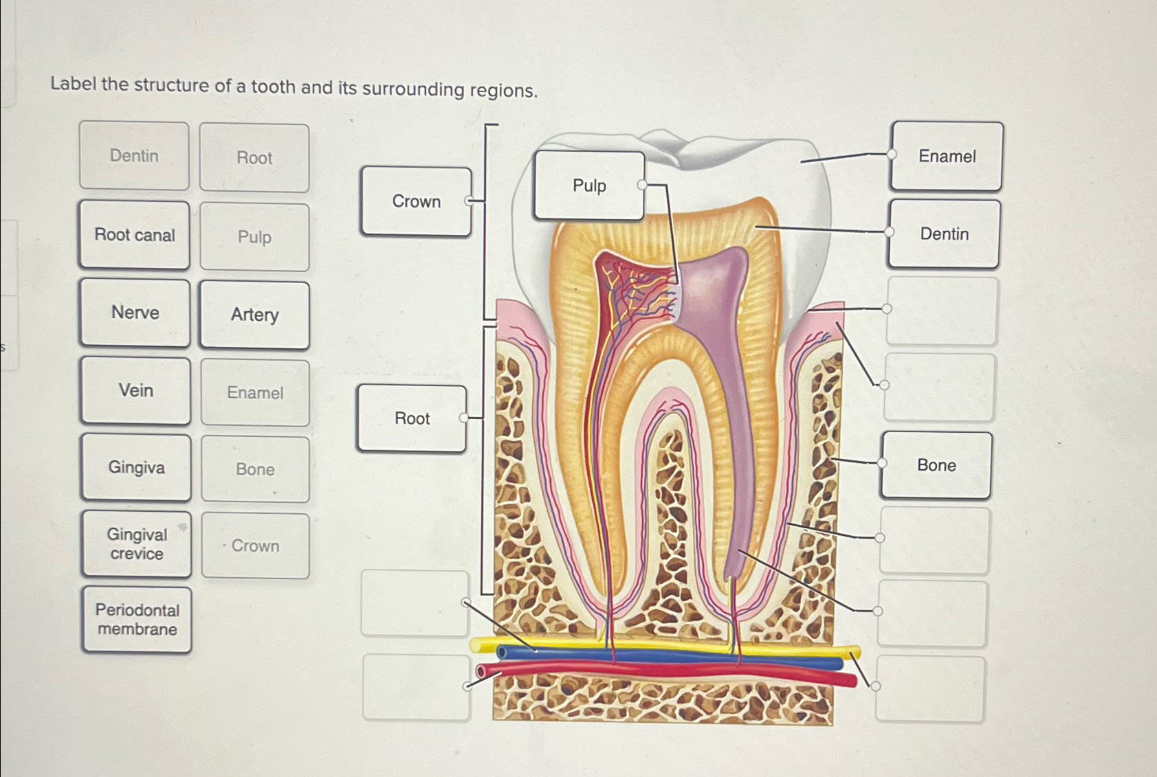 Solved Label the structure of a tooth and its surrounding | Chegg.com