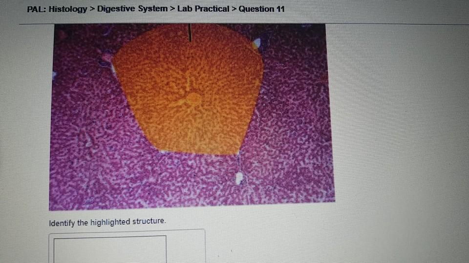 Solved: PAL: Histology > Digestive System > Lab Practical | Chegg.com