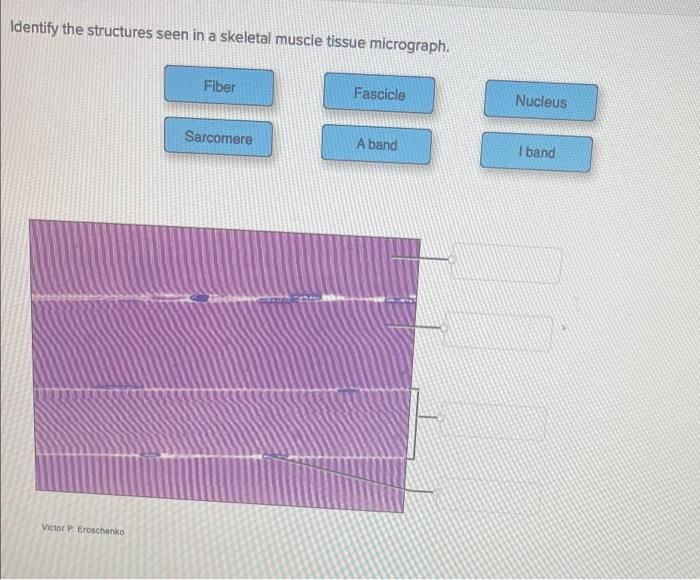 Identify the structures seen in a skeletal muscle tissue micrograph.
Victor P. Eroschenko
Fiber
Sarcomere
Fascicle
A band
Nuc