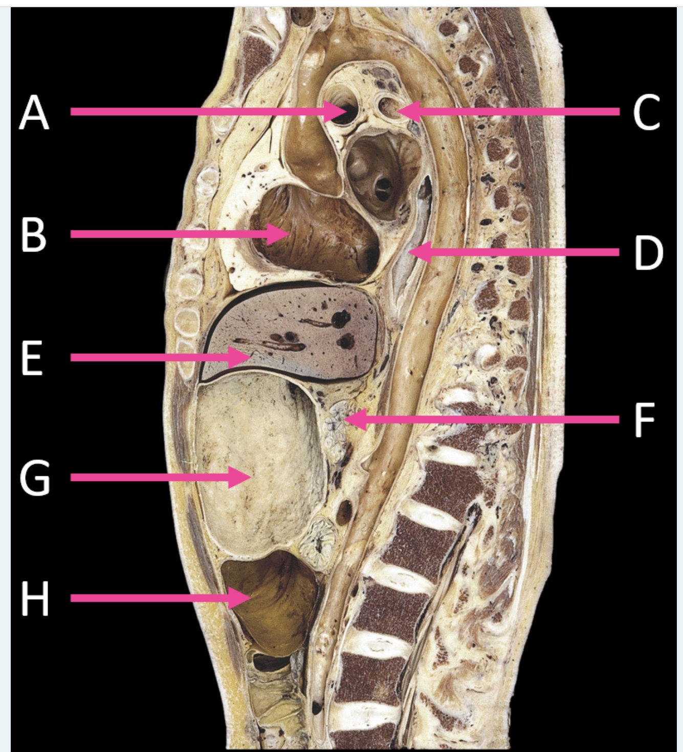 Solved Pleaee help with this thorax cross section | Chegg.com