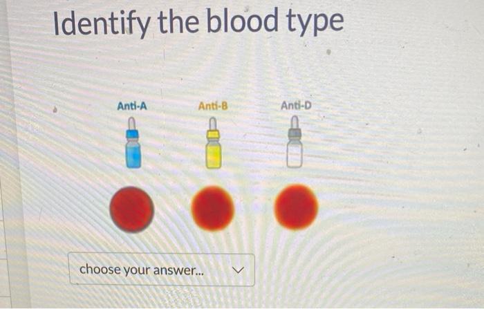 [Solved]: Identify the blood type: Identify the blood type