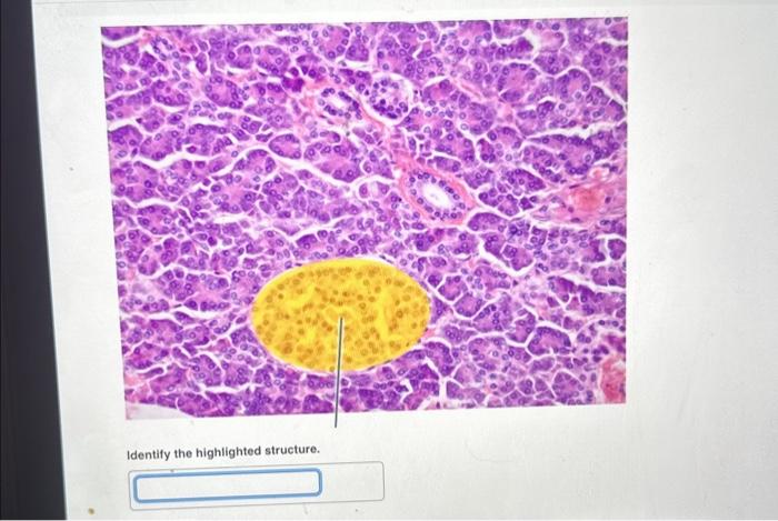 Solved Identify the highlighted structure. | Chegg.com