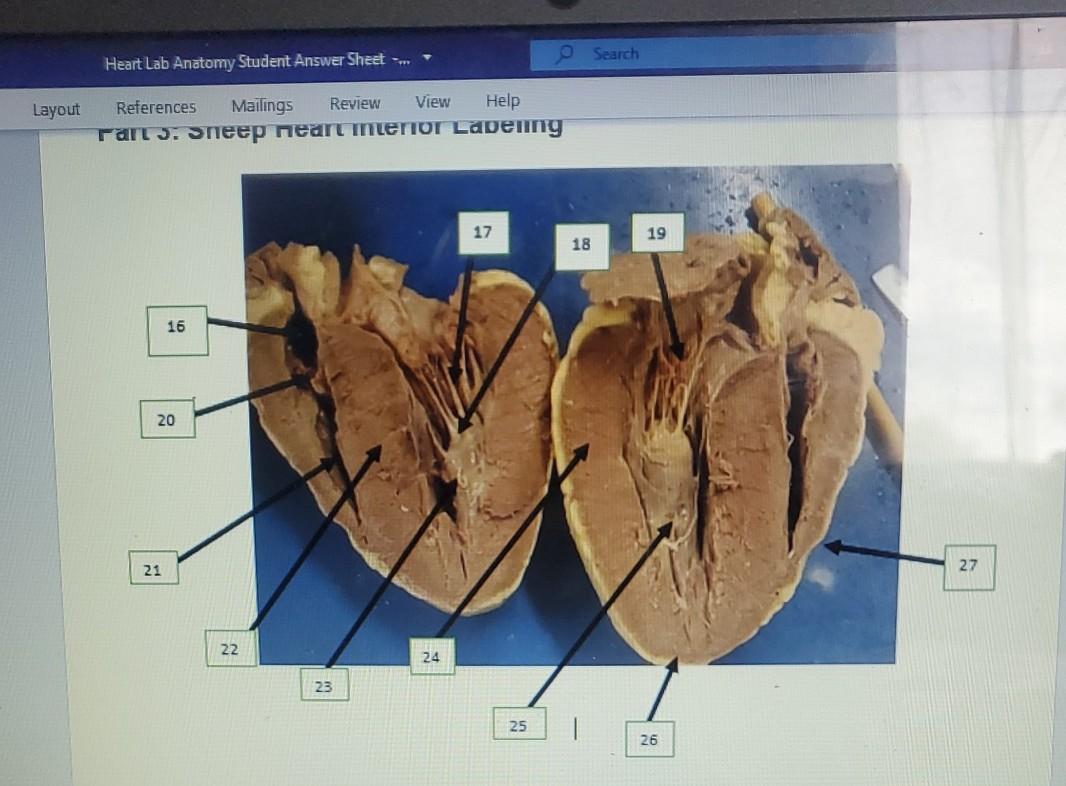 Solved Search Heart Lab Anatomy Student Answer Sheet --- | Chegg.com