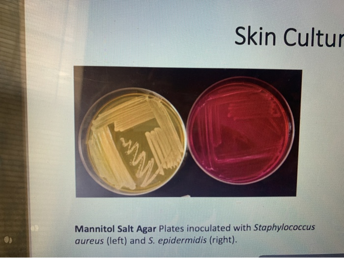 Solved Skin Cultur Mannitol Salt Agar Plates Inoculated W Chegg Com