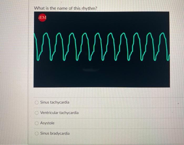 Solved What Is The Name Of This Rhythm Nhunhunhunkumhamh Chegg Com