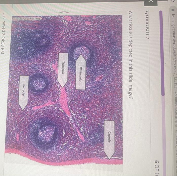 Solved What Tissue Is Depicted In This Slide Image? 