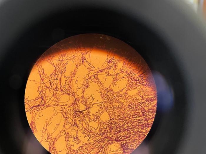 Solved With The Photo Taken Of Gram Stain Unknown. Answer | Chegg.com