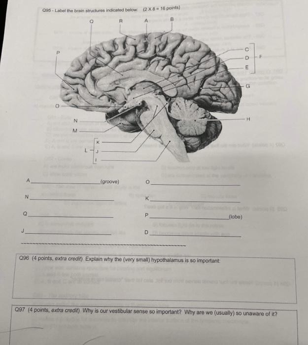 Solved 095 - Label the brain structures indicated below: 2x8 | Chegg.com