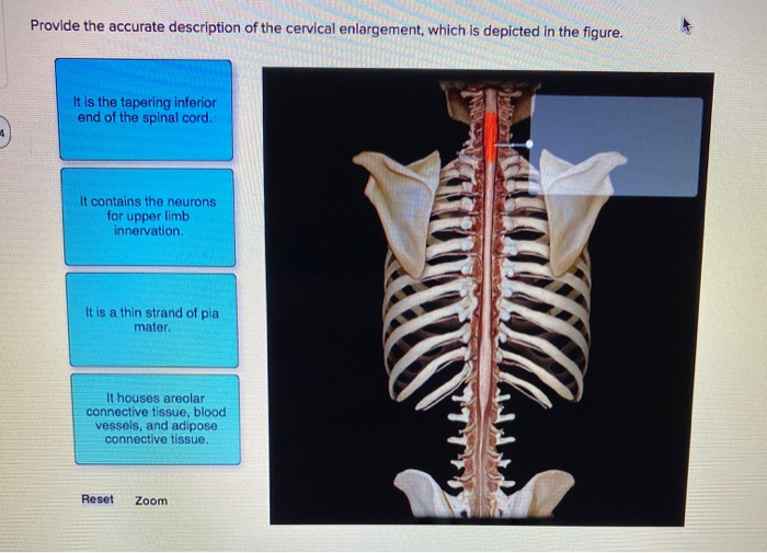 solved-provide-the-accurate-description-of-the-cervical-chegg