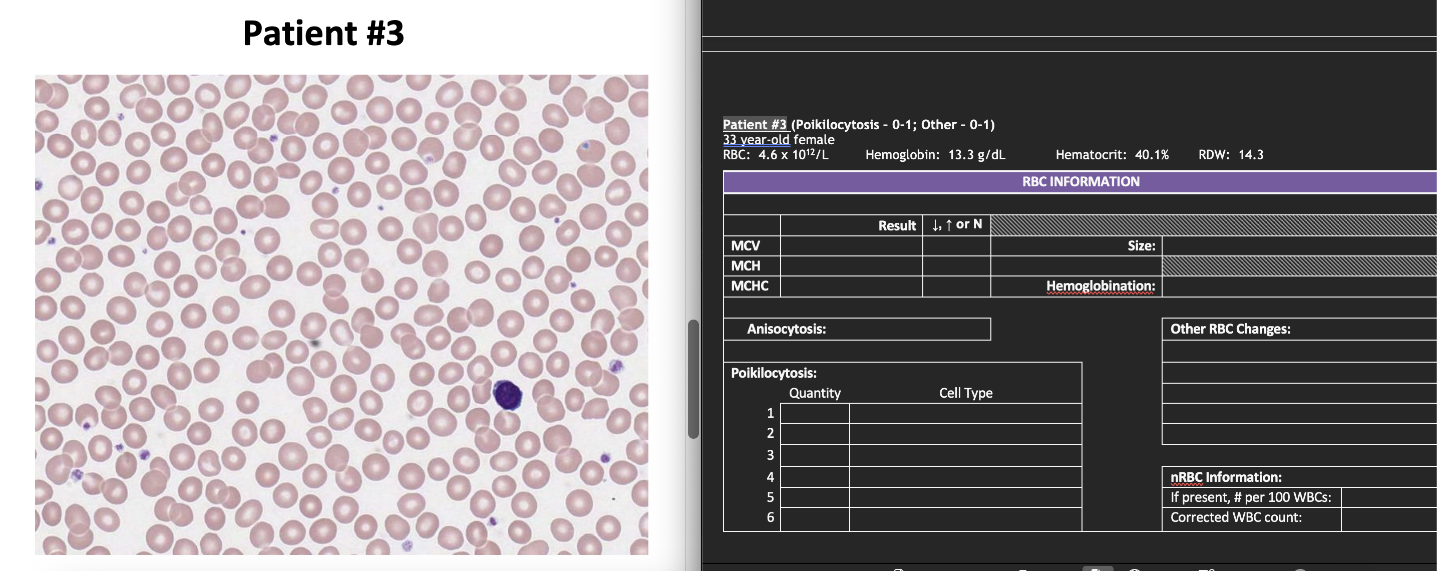 Normal Rbc In Slides Solved Complete an RBC MorphologyScan for the patient. | Chegg.com