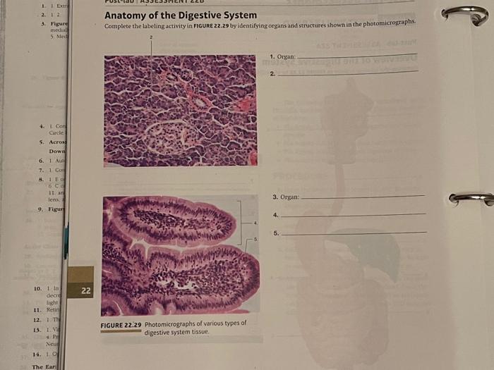 Solved Anatomy of the Digestive System Complete the labeling | Chegg.com