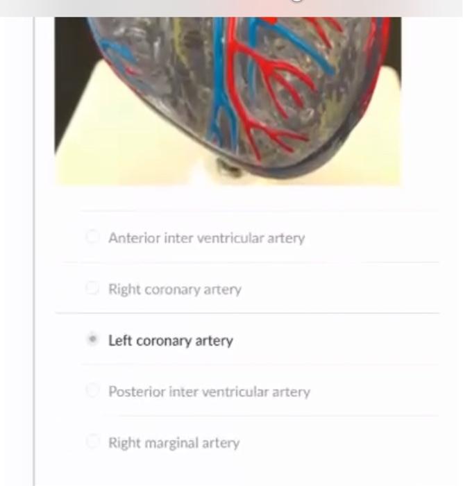 Anterior inter ventricular artery
Right coronary artery
Left coronary artery
Posterior inter ventricular artery
Right margina