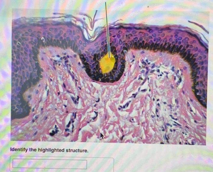 Solved Identify the highlighted structure. Identify the | Chegg.com