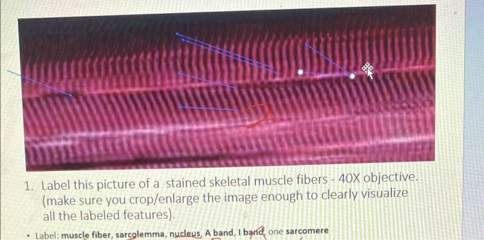 skeletal muscle fiber labeled