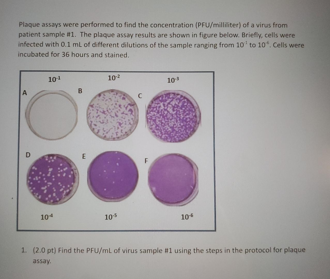 Solved Plaque assays were performed to find the