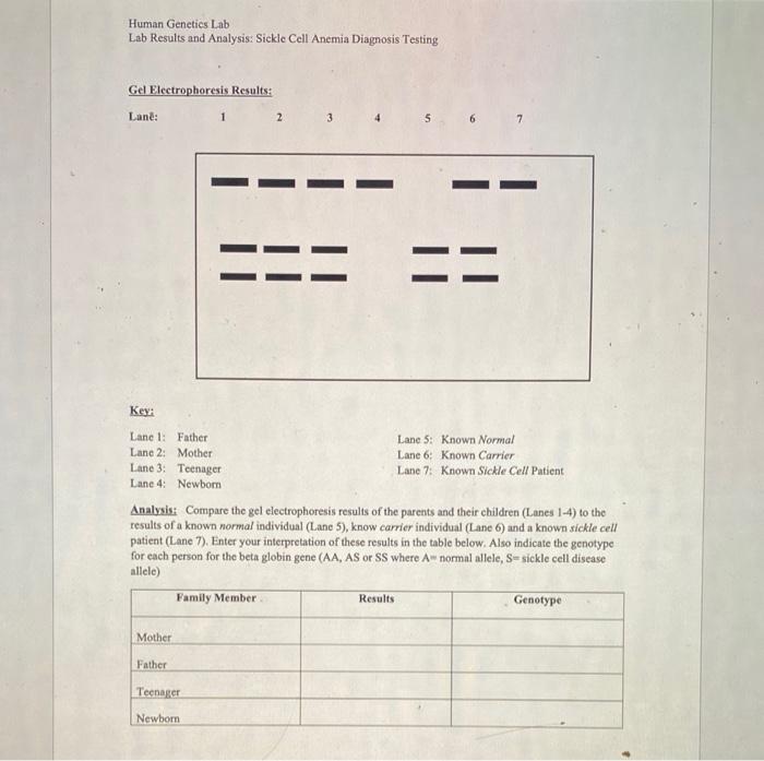 Human Genetics Lab
Lab Results and Analysis: Sickle Cell Anemia Diagnosis Testing
Gel Electrophoresis Results:
Lanê:
1
2
3.
5