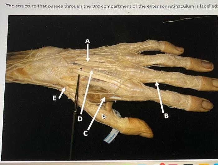The structure that passes through the 3rd compartment of the extensor retinaculum is labelled:
E
D
A
C
B