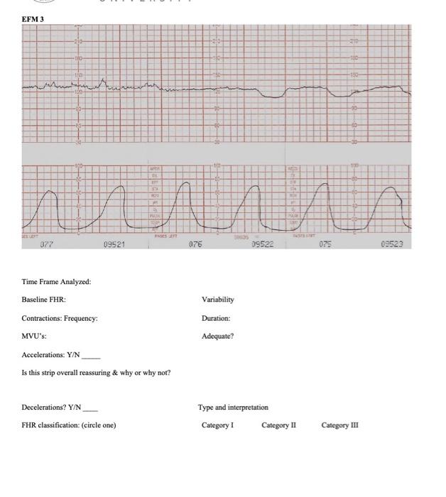 EFM 3 -210 - 10 www.waterwesentanter -- SES LEFT 377 09521 076 09522 075 09523 Time Frame Analyzed Baseline FHR: Contractions