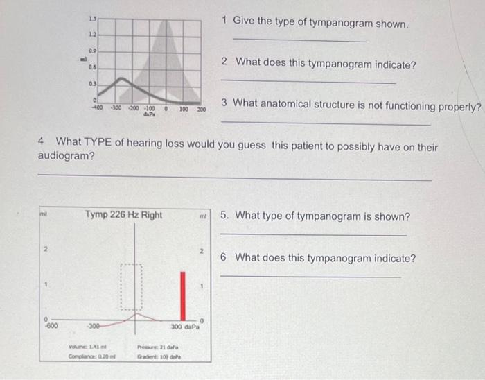 Solved 1 Give the type of tympanogram shown. 2 What does
