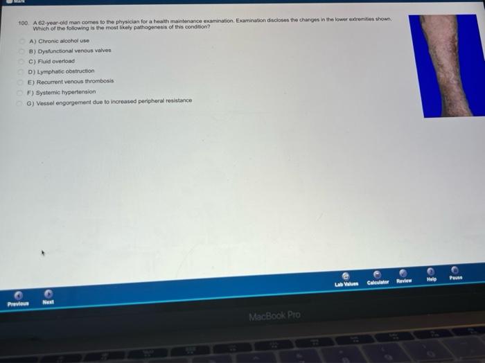 Solved 100 A 62-year-old man comes to the physician for a | Chegg.com