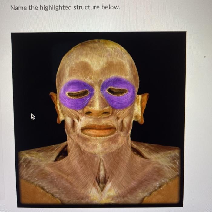 Solved Name the highlighted structure below. Orbicularis Chegg