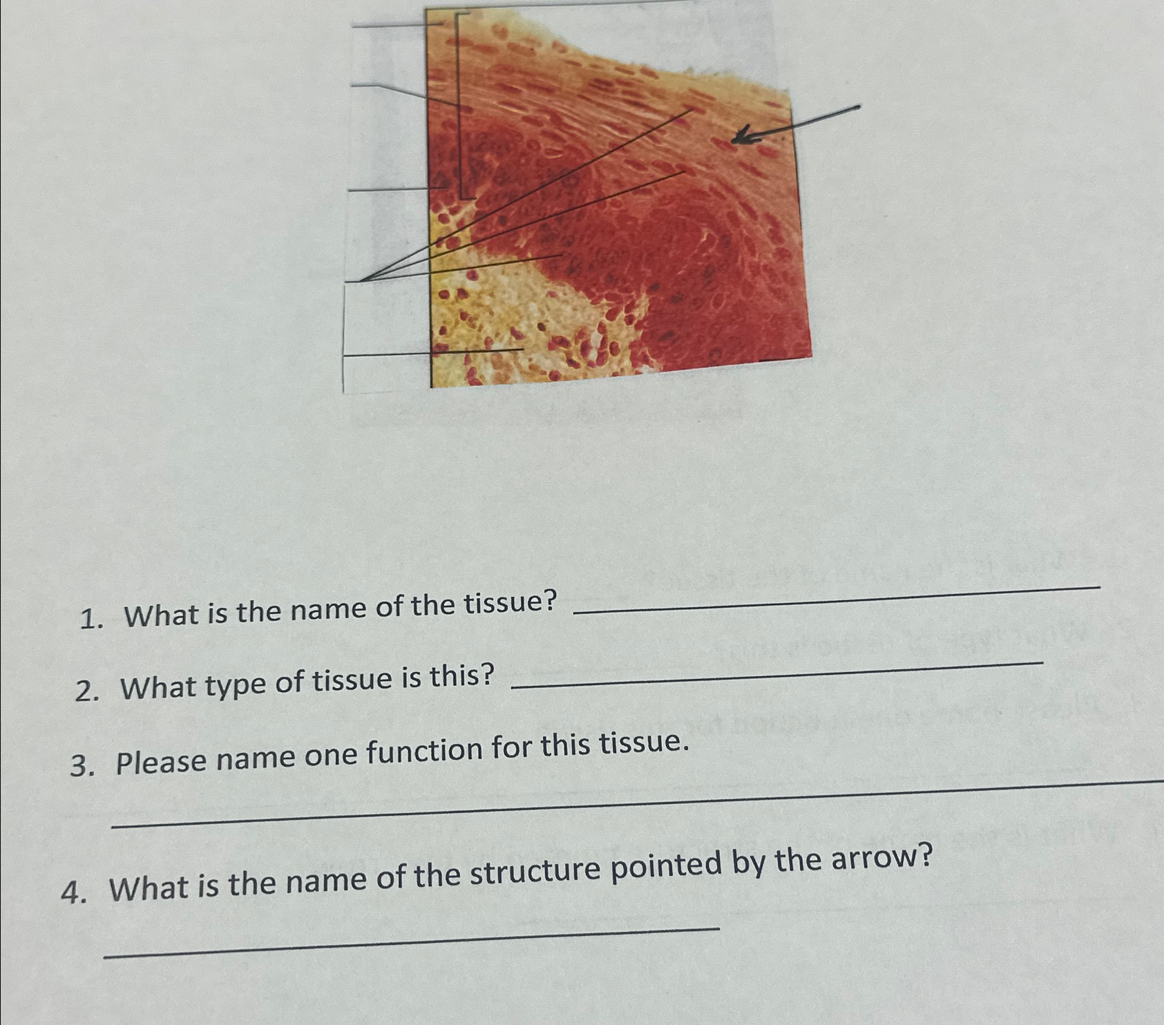 Solved What is the name of the tissue?What type of tissue is | Chegg.com