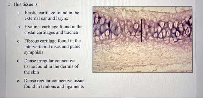 hyaline cartilage connective tissue trachea