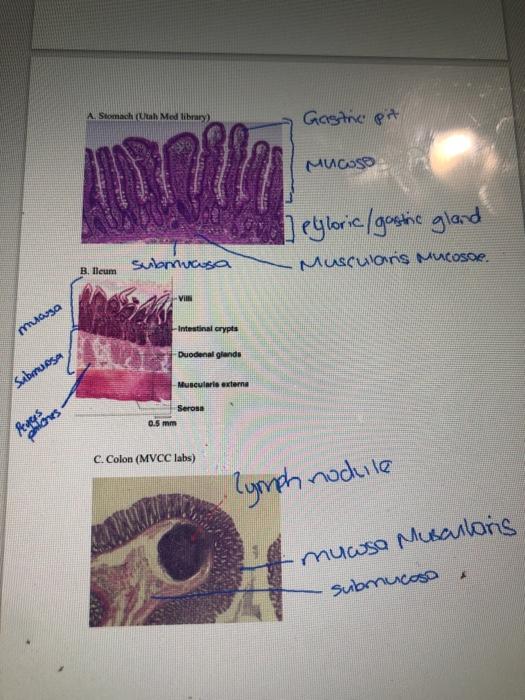 Solved 19. What Region (s) Of The Gi Tract Shown, In The 