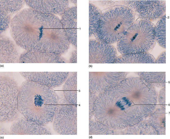 solved-identify-the-mitotic-stage-represented-by-each-of-the-micr