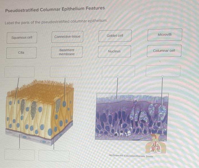 Pseudostratified Columnar Epithelium Features | Chegg.com