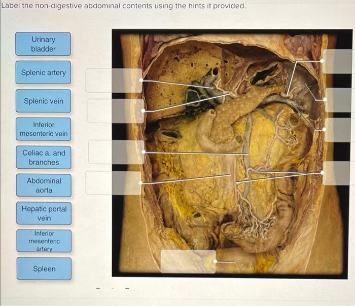 Solved Label the nondigestive abdominal contents using the