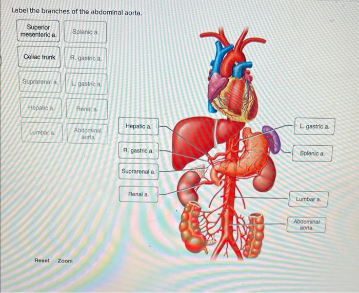 abdominal aorta celiac trunk