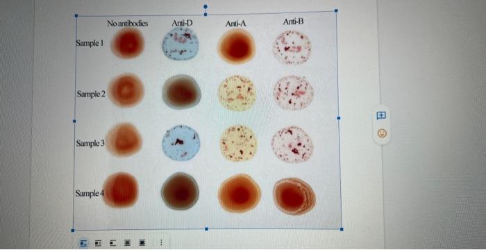 Solved Sample I Sample 2 Sample 3 Sample 4 | Chegg.com