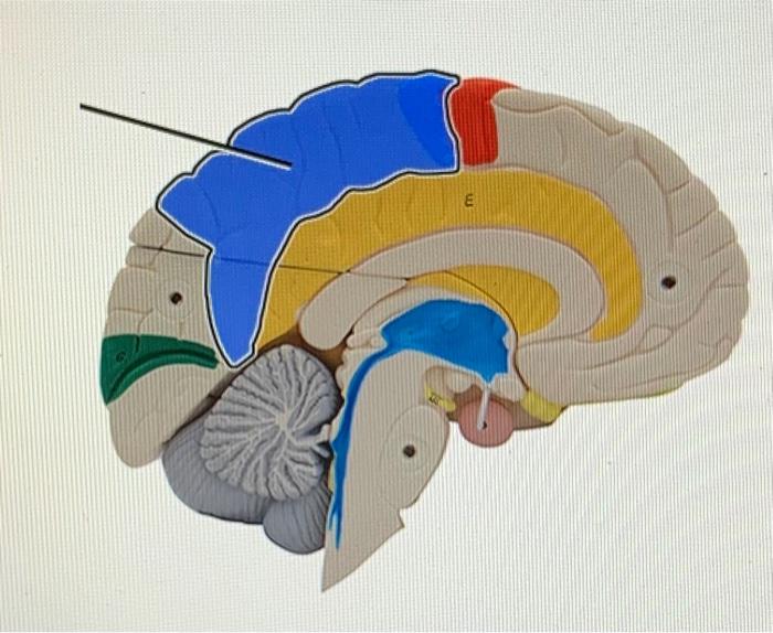 Solved Which structure is highlighted and indicated by