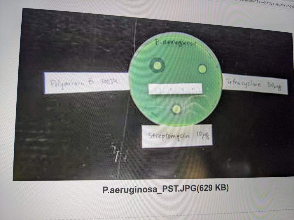 Disk Diffusion Results Diameter of Zone of Inhibition | Chegg.com