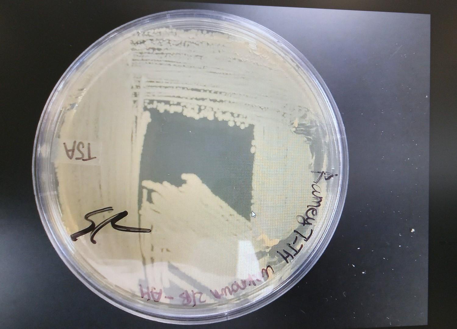 what are the colony and broth characteristics for | Chegg.com