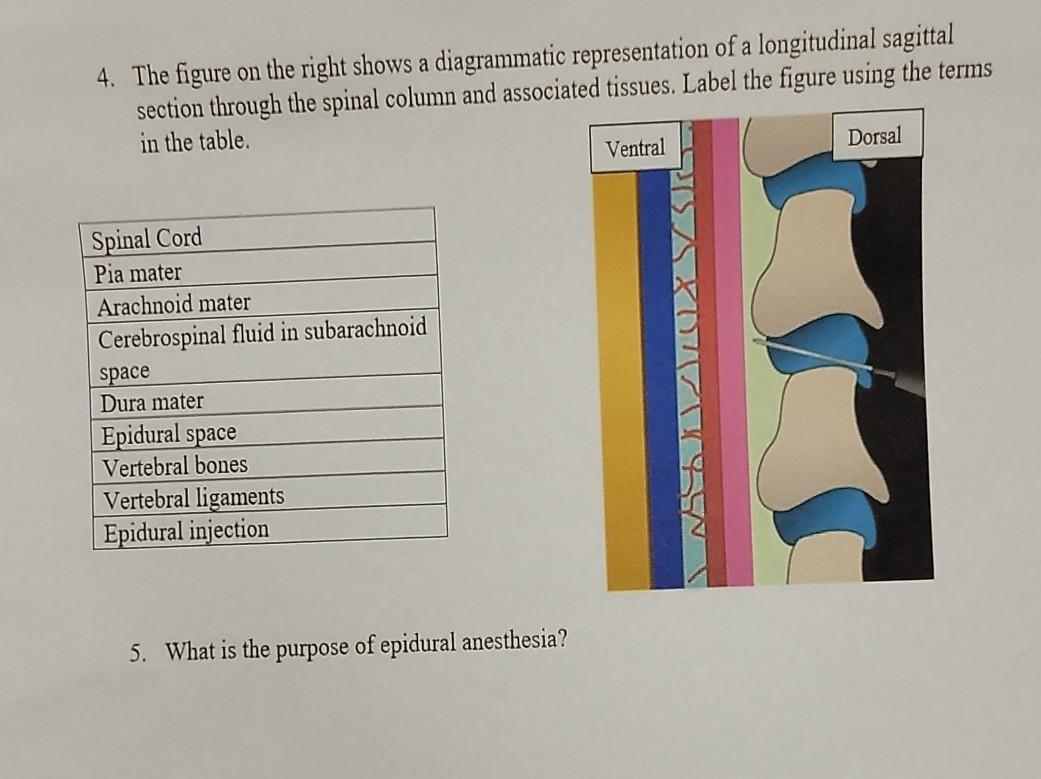 Solved 4. The figure on the right shows a diagrammatic | Chegg.com