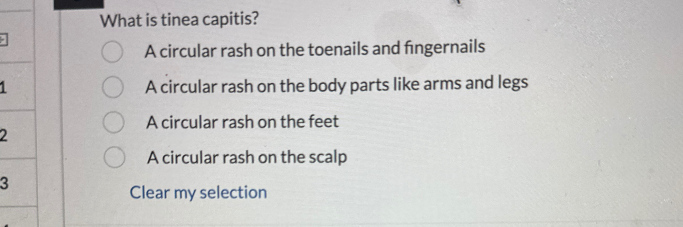 What is tinea capitis?A circular rash on the toenails | Chegg.com