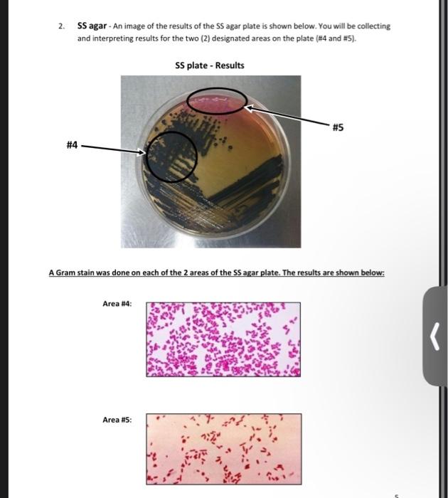 Solved Collect and interpret results 1. EMB plate The