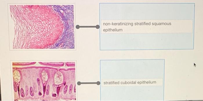 Solved Rearrange the epithelium types to correspond to the | Chegg.com