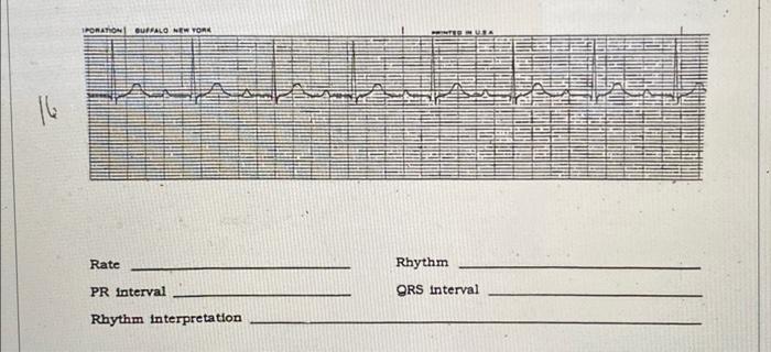 Rate Rhythm PR interval gRS interval Rhythm | Chegg.com