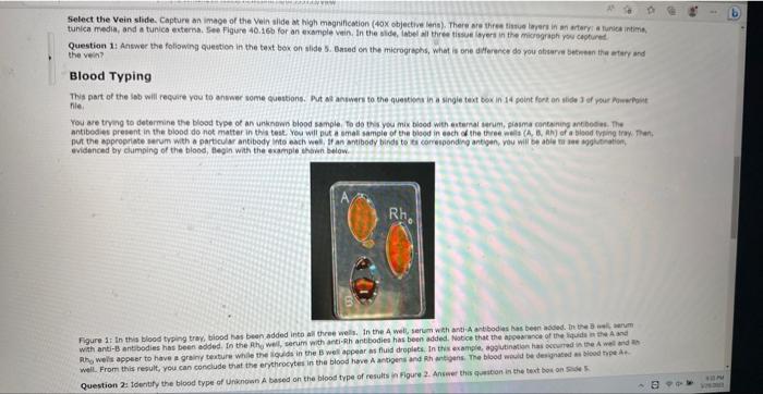Select the Blood Smear Stained. Capture an image of | Chegg.com