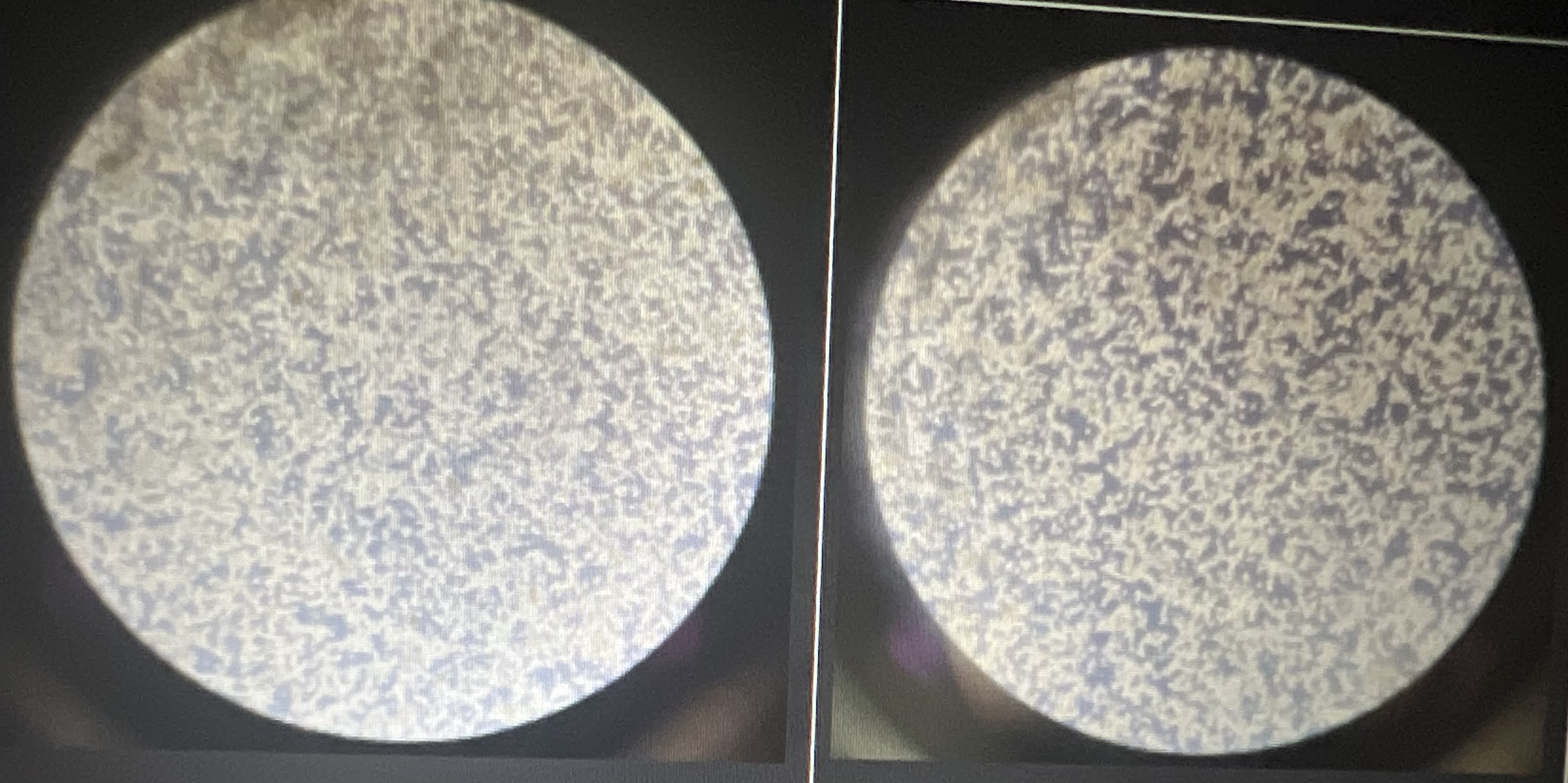 Solved Left side is before medium change and right side is | Chegg.com