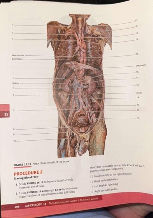 FICURE 18.19 Major blood vessels of the trunk. | Chegg.com