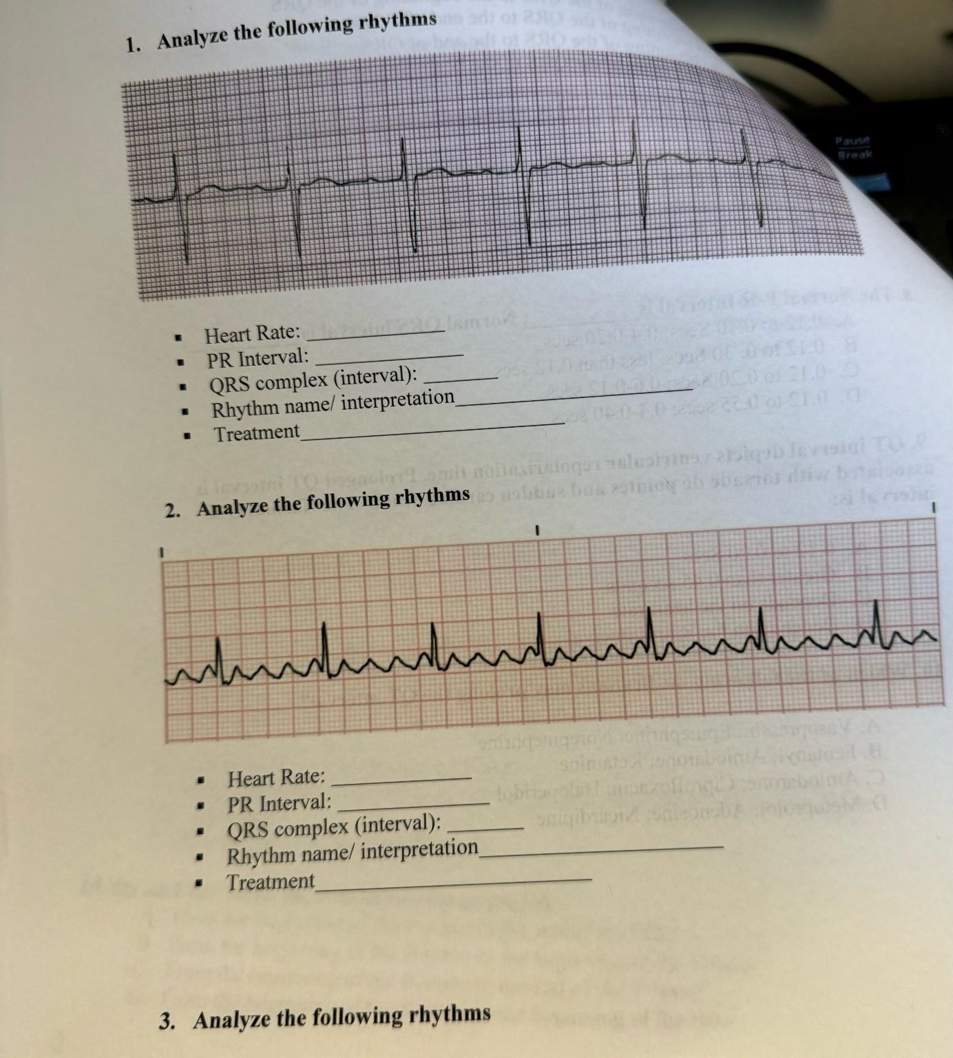 Solved Analyze the following rhythmsHeart Rate:PR | Chegg.com