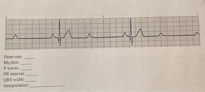 Solved Heart rate: Rhythm: P waves: PR interval: QRS width: | Chegg.com