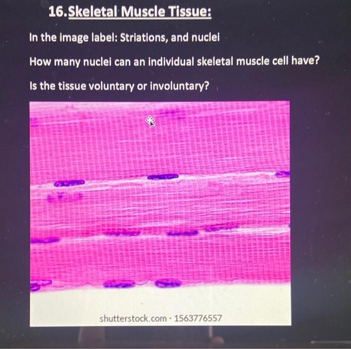 Solved 16. Skeletal Muscle Tissue In the image label