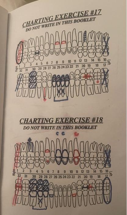 Solved CHARTING EXERCISE \#17 CHARTING EXERCISE \#18 DO NOT | Chegg.com