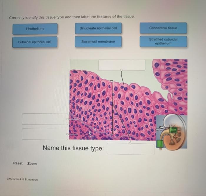 Solved Correctly Identify This Tissue Type And Then Label | Chegg.com